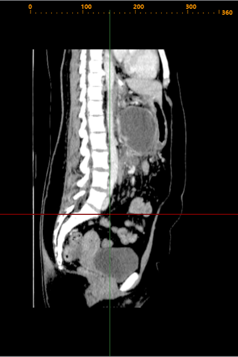 We offer a state-of-the-art solution for viewing and analyzing DICOM files. Our software is designed to cater to the needs of healthcare professionals across the globe, ensuring precision, reliability, and ease of use.